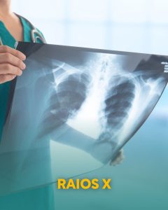 Banner ilustrativo do exame de Raios X